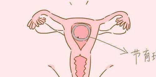 上环之后可以吃瓜吗